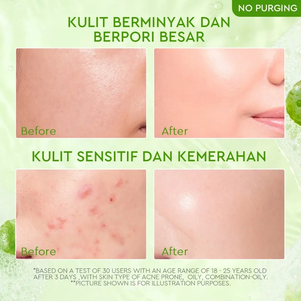Glad2Glow Centella Salicylic Acid Acne Gel Cleanser 4 Glad2Glow Centella Salicylic Acid Acne Gel Cleanser - Gambar 3