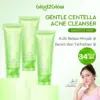 Glad2Glow Centella Salicylic Acid Acne Gel Cleanser