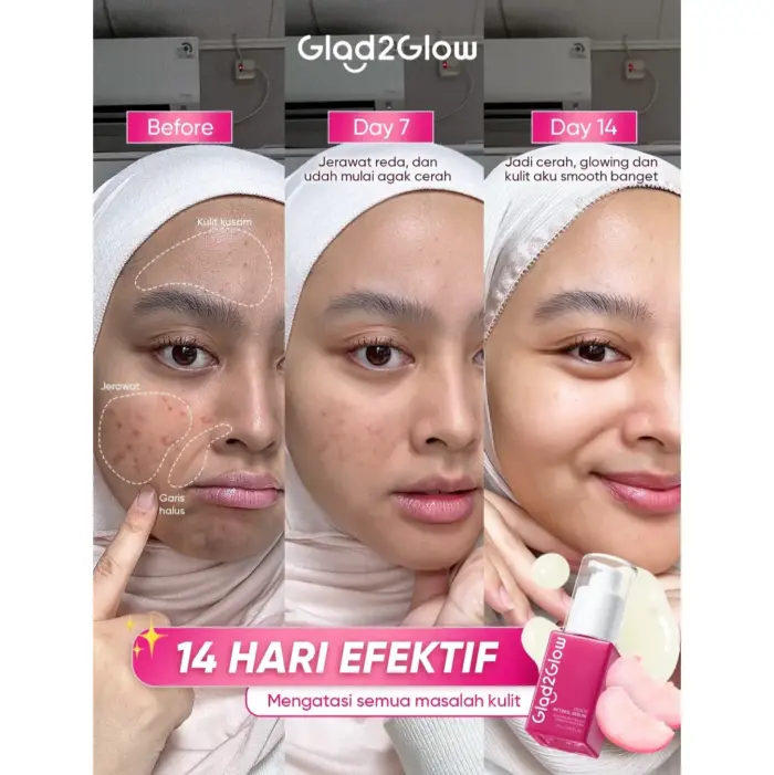 Glad2Glow Peach Retinol Serum - Anti Kerut - Gambar 4