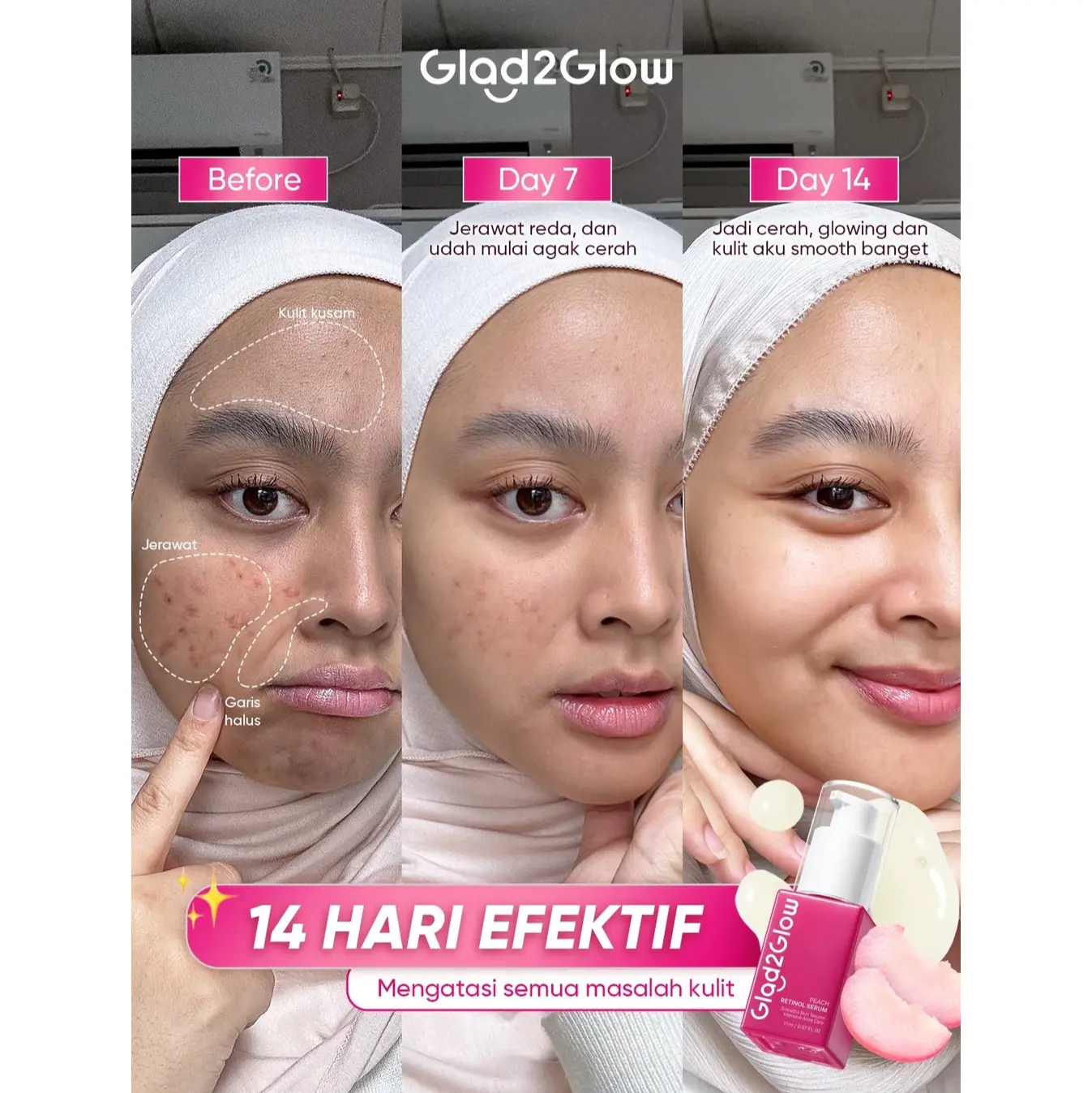 Glad2Glow Peach Retinol Serum 4 Glad2Glow Peach Retinol Serum - Anti Kerut - Gambar 4