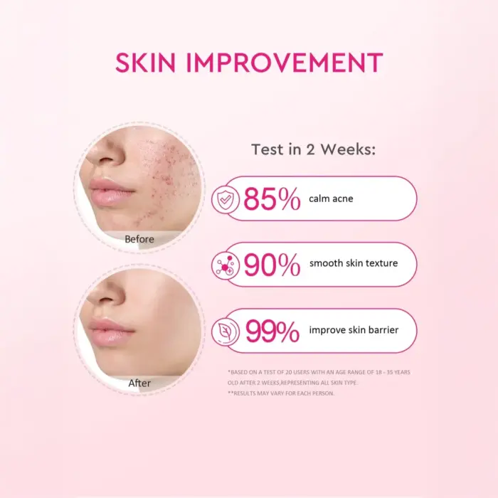 Glad2Glow Peach Retinol Serum - Anti Kerut - Gambar 3