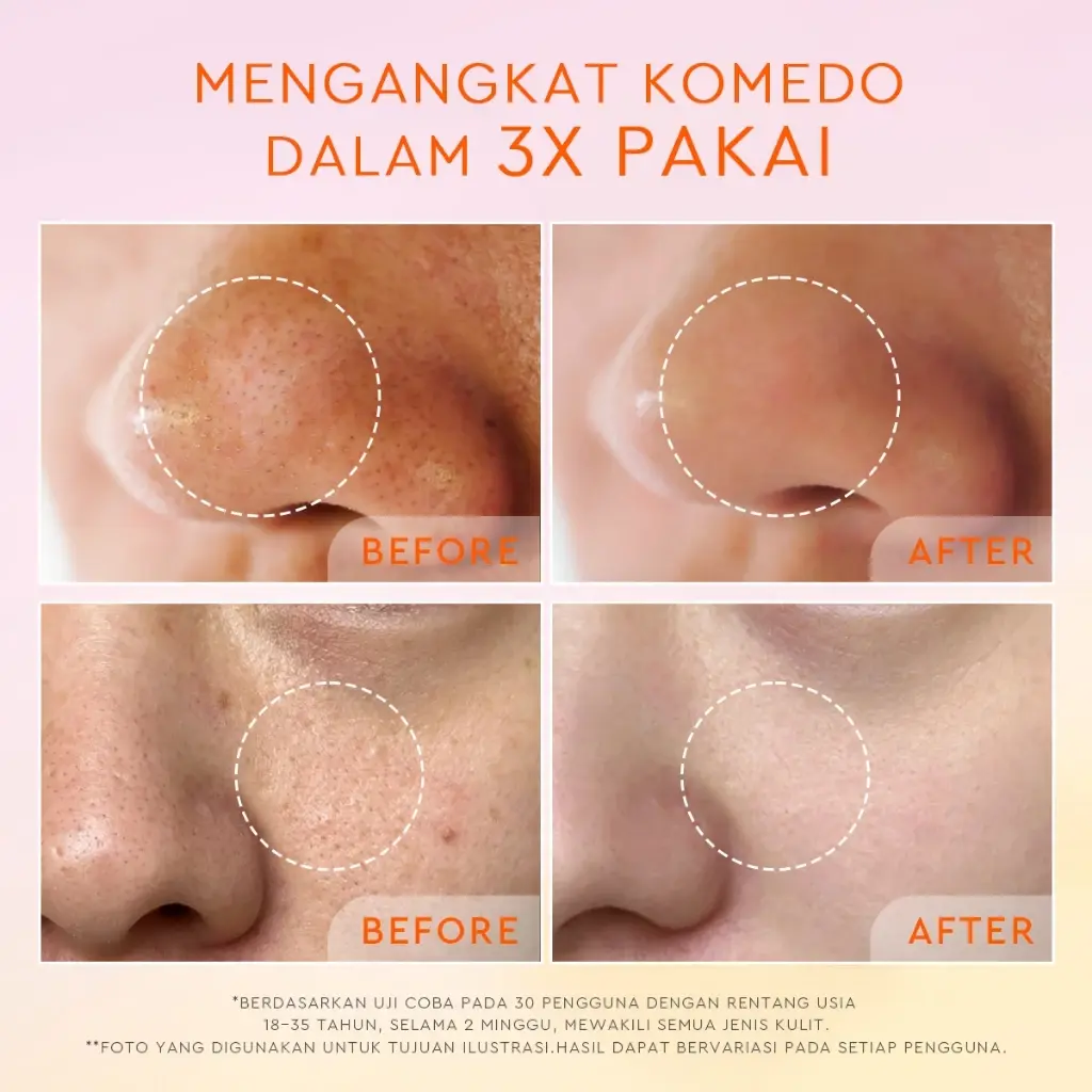 Glad2Glow Yuzu Aha Blackhead Exfoliating Cleanser 5 Glad2Glow Yuzu Aha Blackhead Exfoliating Cleanser - Gambar 4