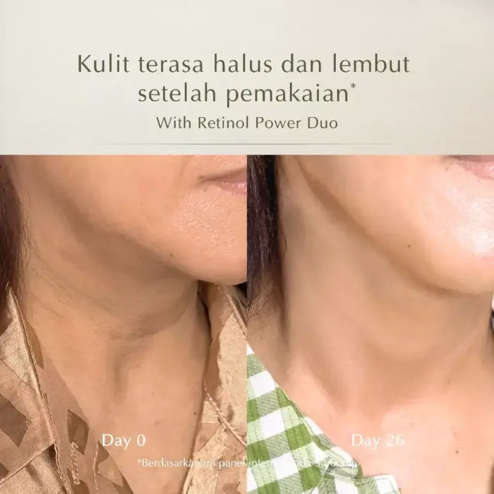 MOSSÈRU Retinol Power Duo Wrinkle Treatment - Gambar 9