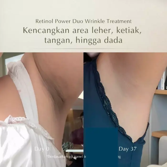 MOSSÈRU Retinol Power Duo Wrinkle Treatment - Gambar 8