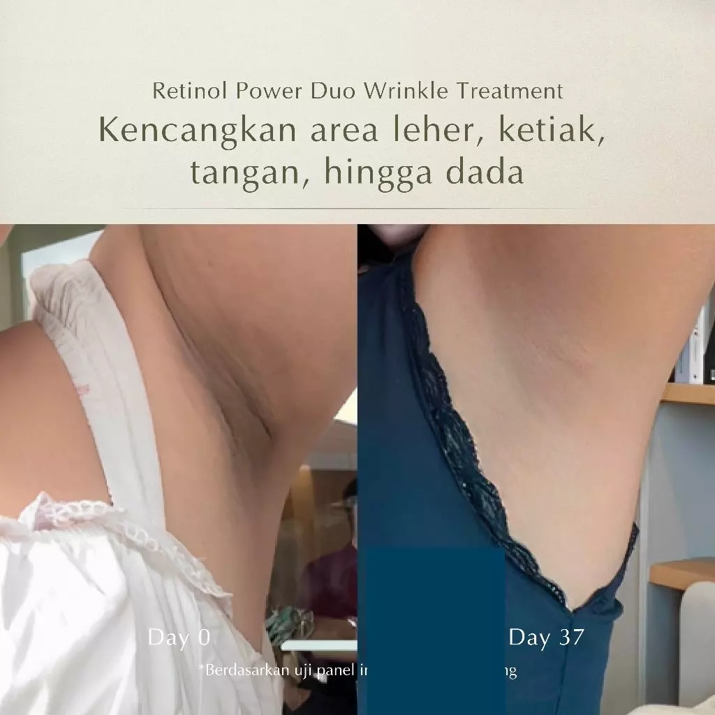 MOSSÈRU Retinol Power Duo Wrinkle Treatment 7 MOSSÈRU Retinol Power Duo Wrinkle Treatment - Gambar 8