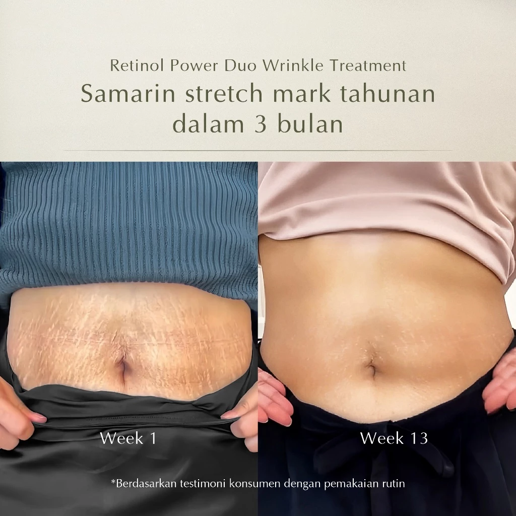 MOSSÈRU Retinol Power Duo Wrinkle Treatment 8 MOSSÈRU Retinol Power Duo Wrinkle Treatment - Gambar 7