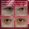 Lanbena Peptides Hydra Anti Wrinkle Eye Mask - Gambar 2