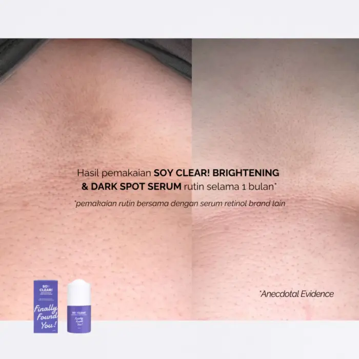 Finally Found You! Soy Clear Brightening & Dark Spot Serum - Gambar 4