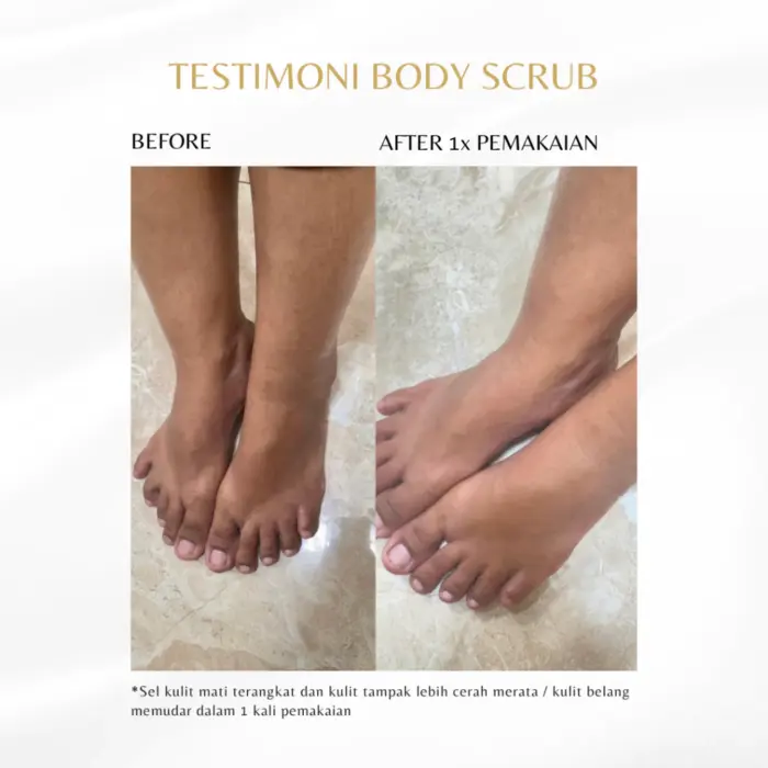 Skinvu Body Scrub & Body Mask - Gambar 6
