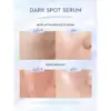 Glad2Glow Yuja Symwhite 377 Dark Spot Serum - Gambar 2