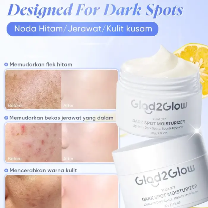 Glad2Glow Yuja Symwhite 377 Dark Spot Moisturizer - Gambar 3